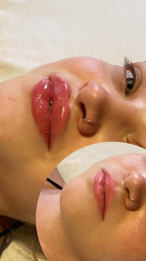 Cesme Lip Appointments